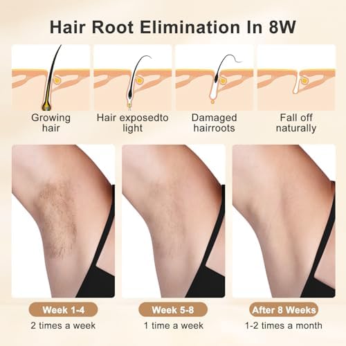 Real Sapphire Painless IPL Laser Hair Removal With 5℃ Ice Cooling For Women Men,Permanent Facial Hair Removal Device At Home, Alternative to Salon Hair Removal For Face, Body, Leg, Arm, Bikini