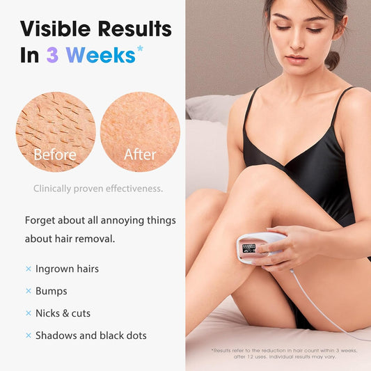 IPL Laser Hair Removal Device for Women & Men - Home 45°F Ice-Cooling Contact for Painless & Long-Lasting Results, 86% Hair Reduction in 3 Weeks for Full Body & Bikini Line, Rose Gold - PuriLite
