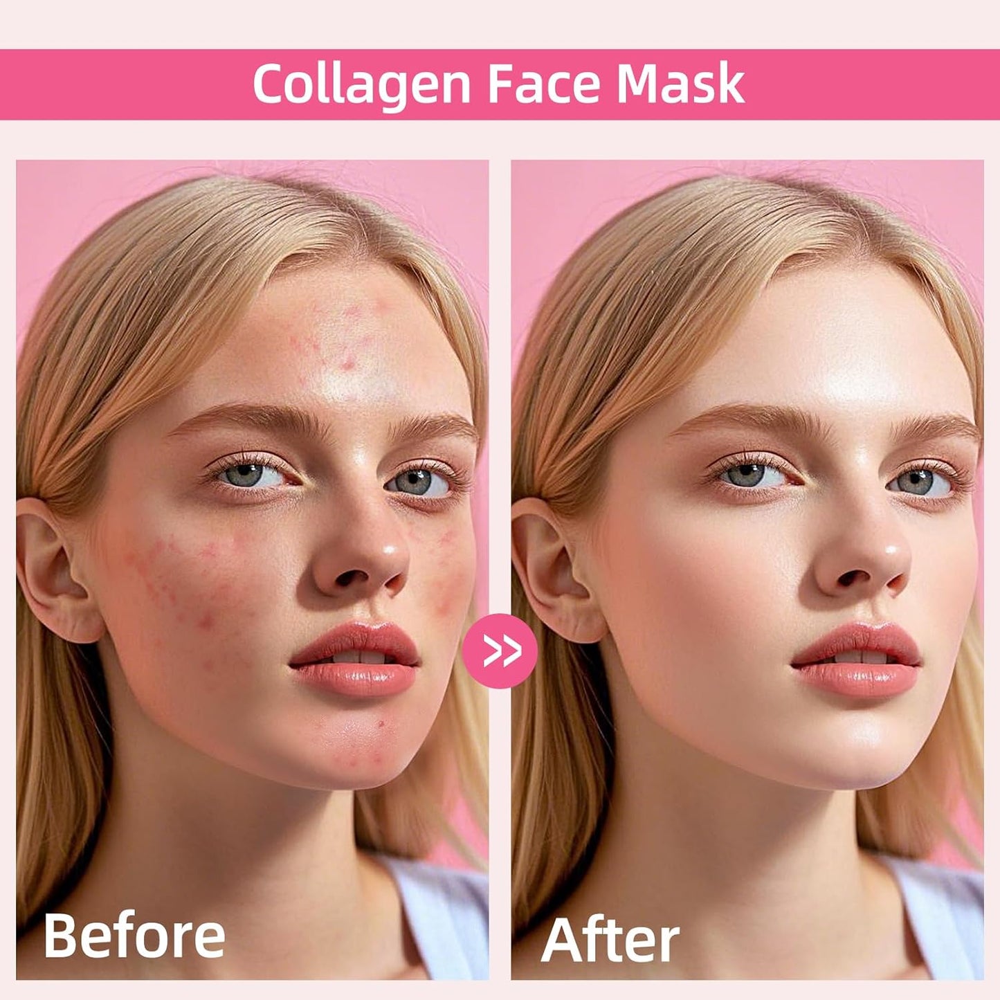 dewyhour Collagen Face Mask: 5 Pack Hydrating Deep Collagen Mask Overnight Sheet Mask with Hyaluronic acid,Pore Minimizing,Elasticity Skin