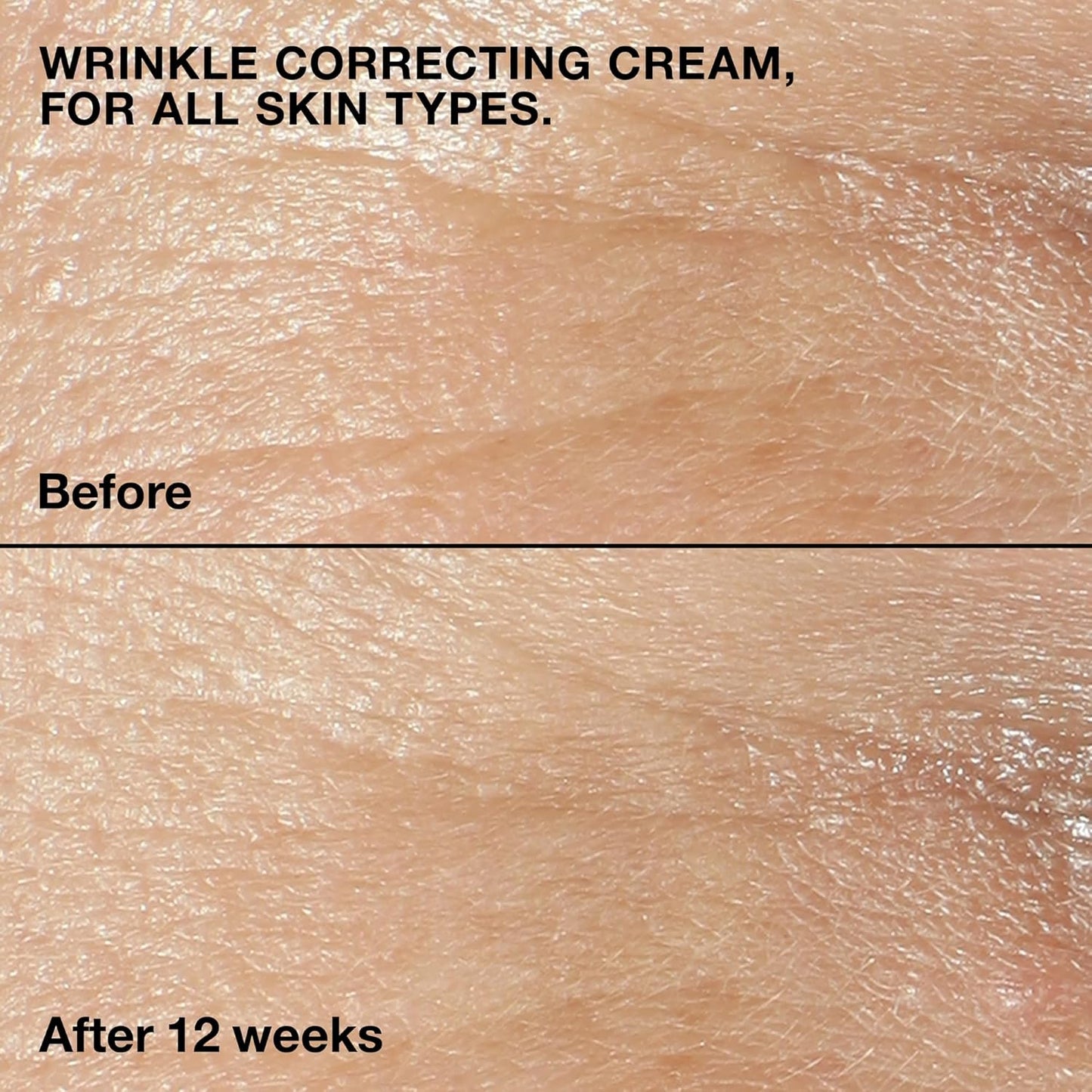 Clinique Wrinkle Fighting Routine Set| Anti-Aging Gift Set For Her