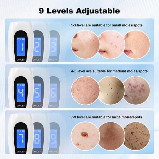 Purilite Select Skin Tag Pen – Portable Home Kit for Skin Tags, Moles & Warts - PuriLite
