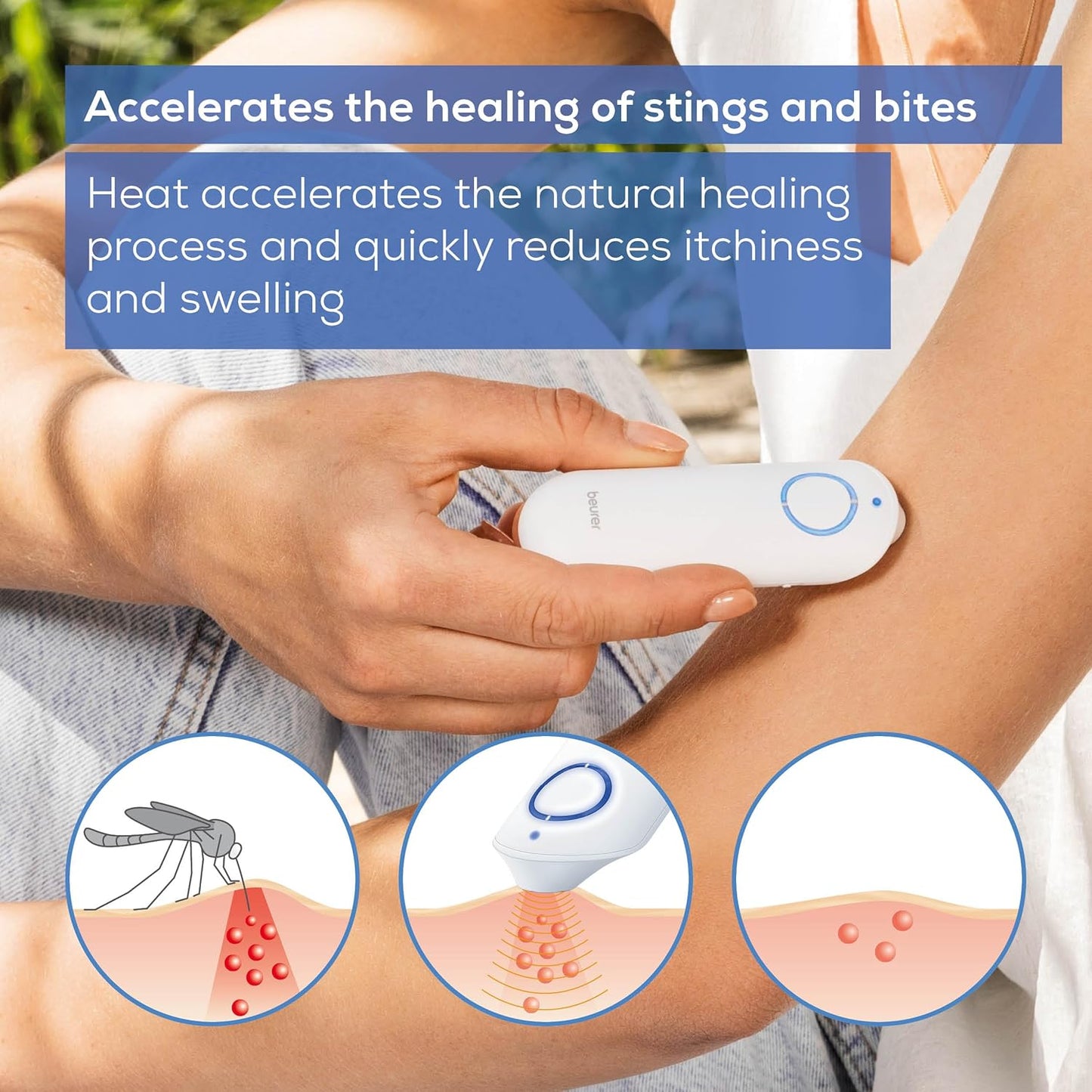 Beurer BR 60 Insect Bite Healer Pen For The Treatment Of Insect Bites And Stings, Provides Natural Relief From Itching And Swelling Without Medication, Certified Medical Device