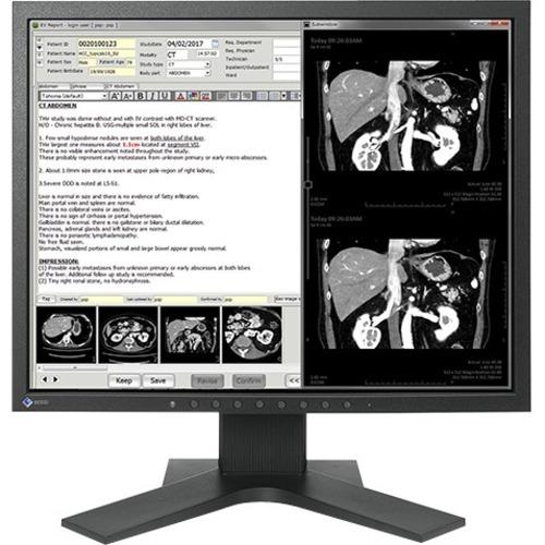 EIZO RadiForce MX194 18.9" SXGA LED LCD Monitor - 5:4 - Black - 1280 x 1024 - 1.07 Billion Colors - 350 cd/m‚² - 20 ms - DVI - VGA - DisplayPort