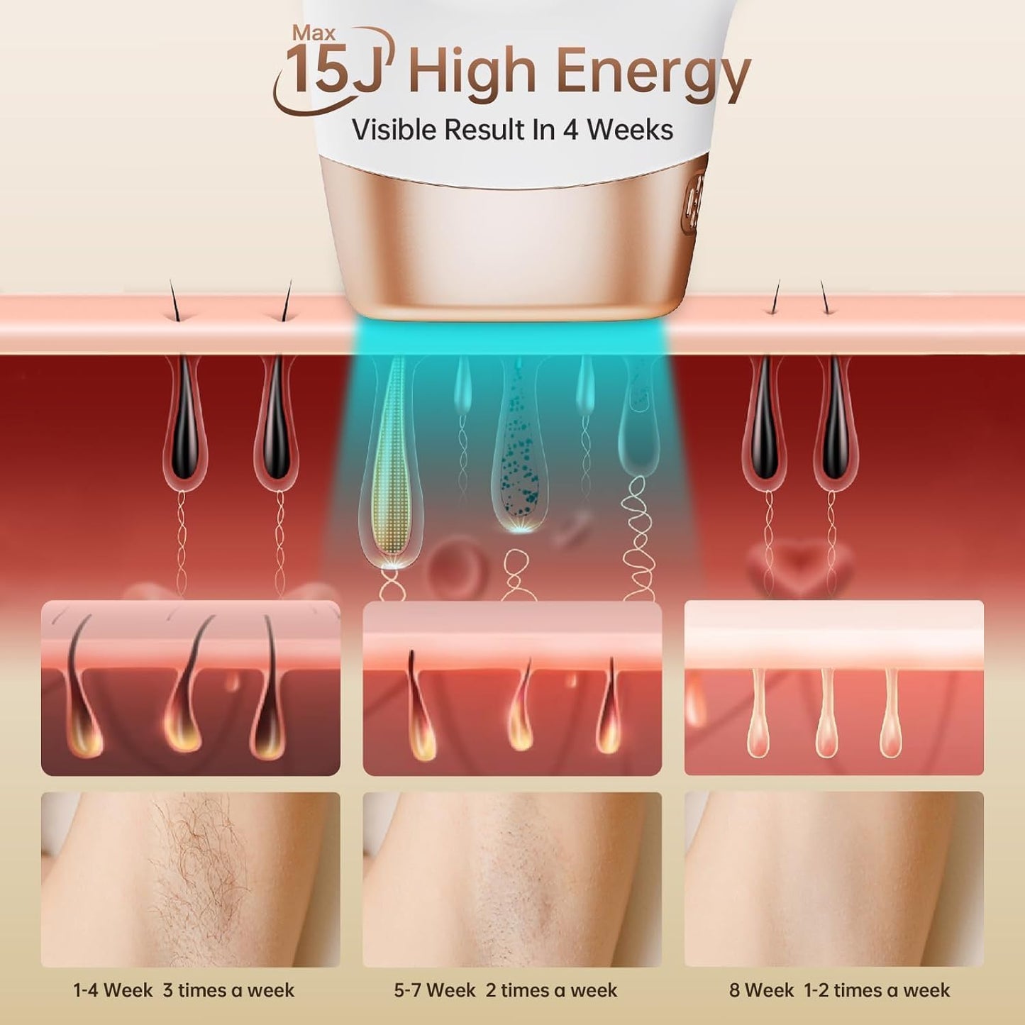 Aopvui Laser Hair Removal for Women and Men, Safe & Nearly Painless Laser Hair Removal Device, At-Home Permanent IPL Hair Removal for Armpits Arms Legs Back Bikini Line & Whole Body Use