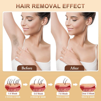 Aopvui Laser Hair Removal for Women and Men, Safe & Nearly Painless Laser Hair Removal Device, At-Home Permanent IPL Hair Removal for Armpits Arms Legs Back Bikini Line & Whole Body Use