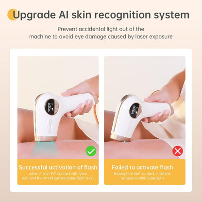 Finequin IPL Hair Removal Device, At-Home Red-light Epilator for Long-Lasting Hair Removal with Nearly Painless Treatment, Facial, Bikini & Whole Body Use