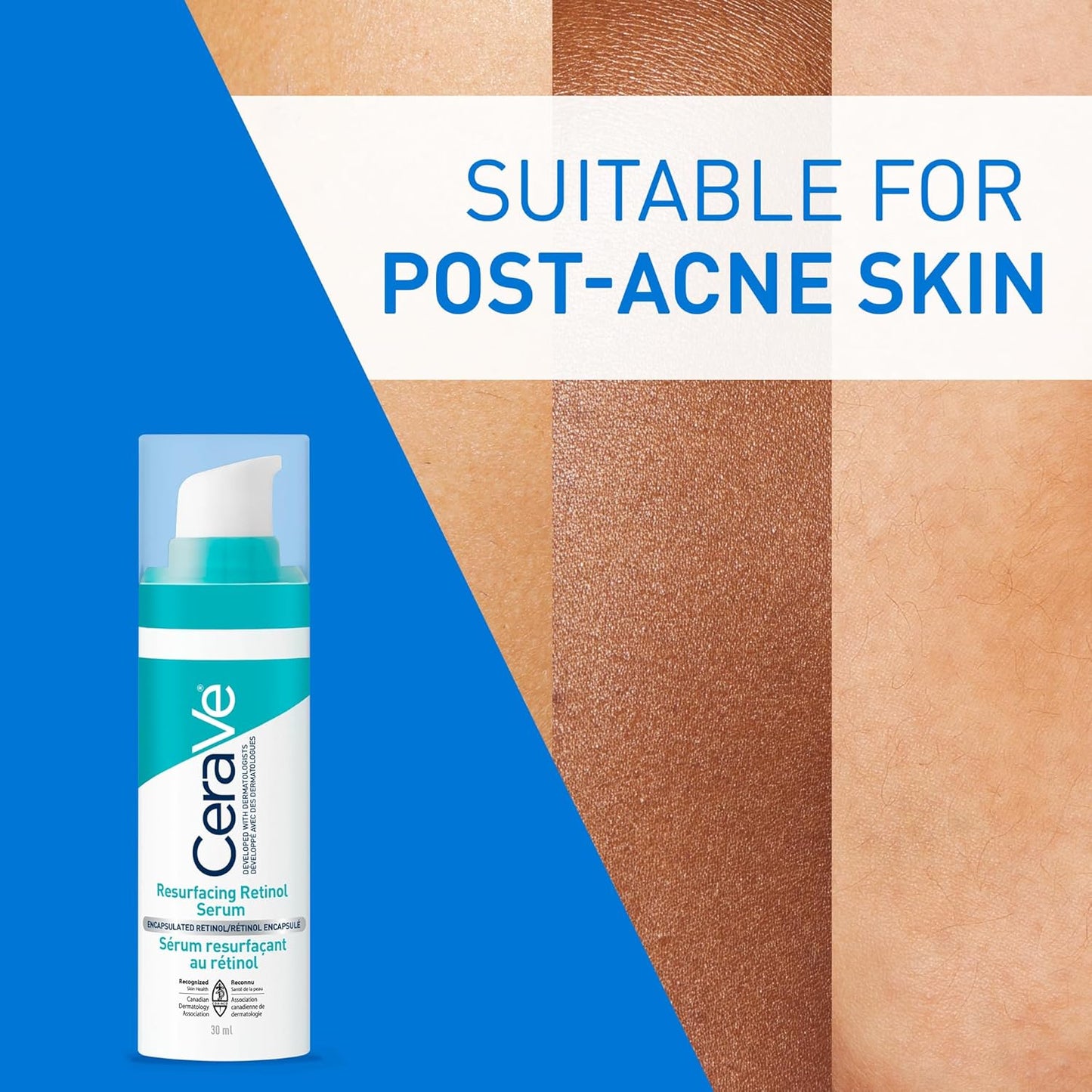 CeraVe Resurfacing RETINOL Serum For Face with Niacinamide. Helps even Skin Tone & Smoothness, Post-Acne Marks & Pore Minimizer. Gentle, Fragrance-free, Non-Comedogenic, Safe for Sensitive Skin, 30ML