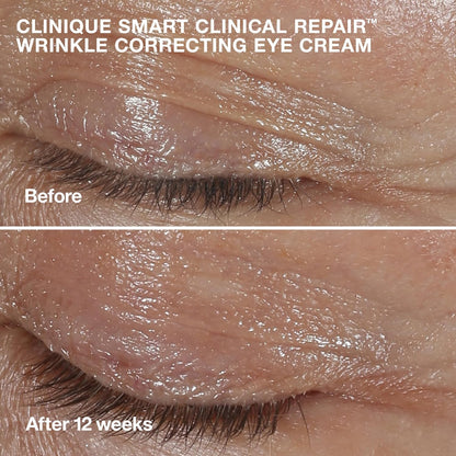 Clinique Wrinkle Fighting Routine Set| Anti-Aging Gift Set For Her
