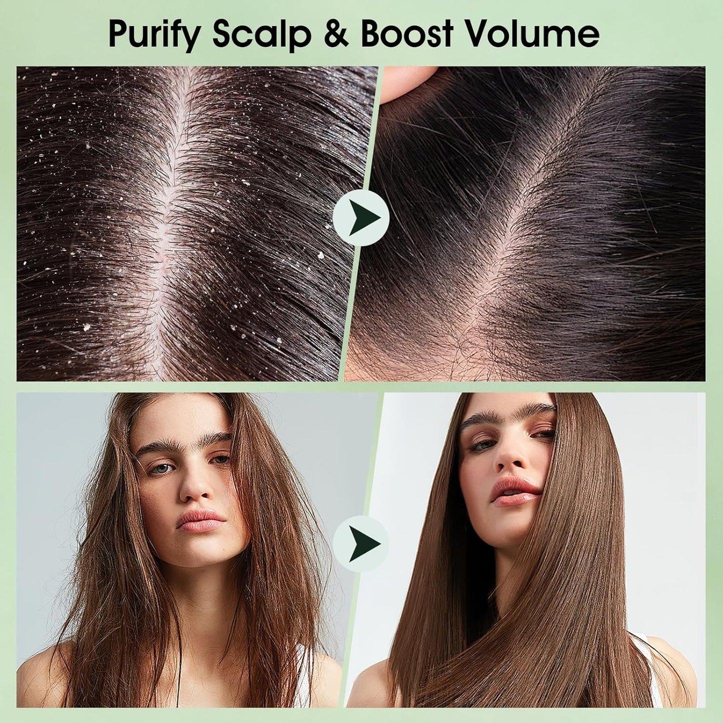 VOERUY Scalp Scrub, Tea Tree Scalp Exfoliator Shampoo, 2-in-1 Hair Treatment with Mint Oil, Clarify and Remove Build up with Silicone Scalp Massager, 10.6oz/300g