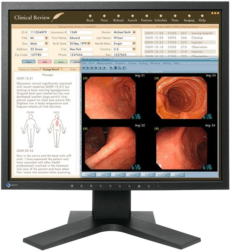 Eizo Radiforce MX194 1MP 19'' Clinical Review Monitor (MX194)