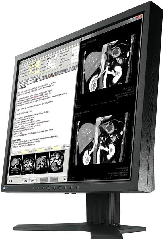 Eizo Radiforce MX194 1MP 19'' Clinical Review Monitor (MX194)