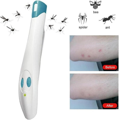 SJHKXAHY Insect Bite Healer Electronic Pen Device Chemical Free Effective for Irritating Insect Stings Lasting Relief Burning Swelling and Pain Anti-Itch Pen Heat Antipruritic Technology,One