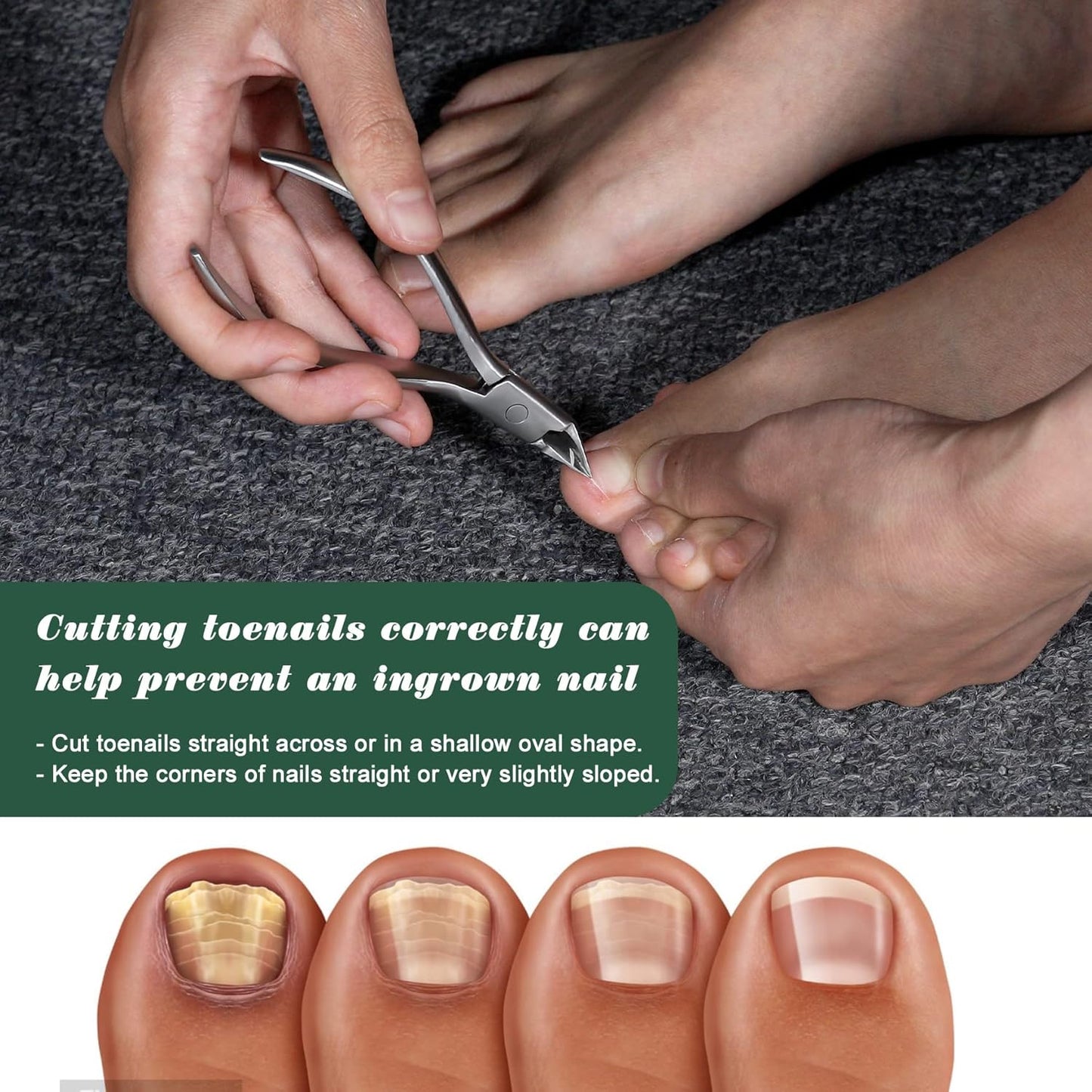 FVION Toenail Clippers for Ingrown Toenail Prevention, Straight Blade Podiatrist Nail Clippers for Thick Nails, Ergonomic Finger Nail Clippers for Adults, Seniors, Men and Women (Black)