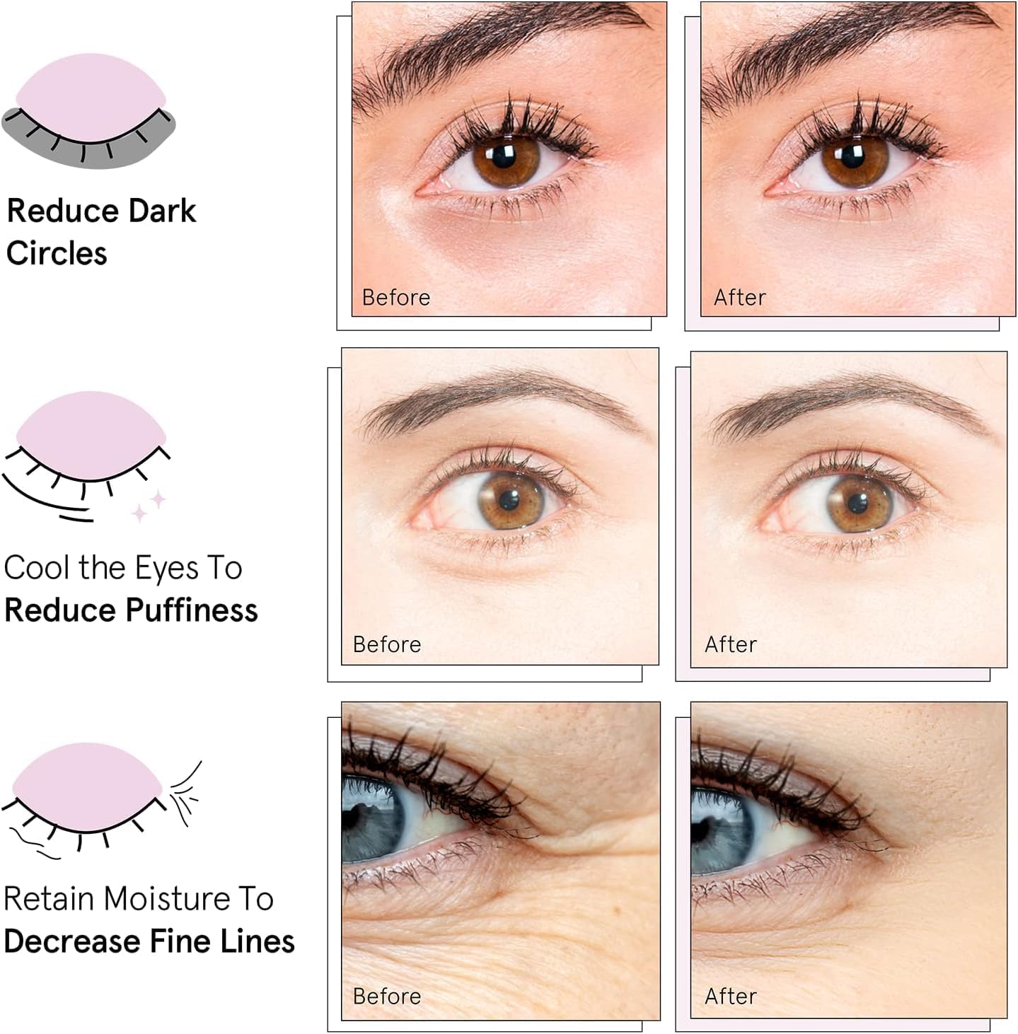 grace & stella Award Winning Under Eye Mask - Gifts for Women - Bridesmaid Proposal Gifts - Reduce Dark Circles, Puffy Eyes, Undereye Bags, Wrinkles - Under Eye Patches - Vegan (24 Pairs, Pink)